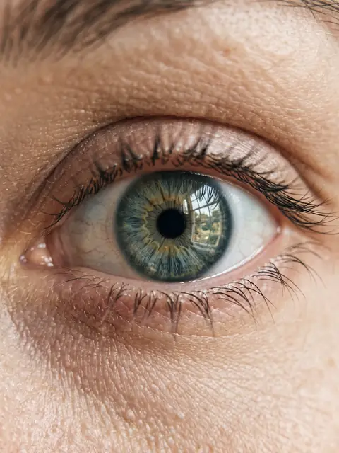 Close-up of a healthy eye with a smooth tear film after dry eye treatment